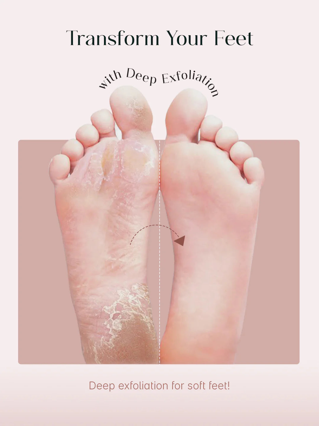 SeoulSkin Glycolic Acid Foot Peeling Mask ( 4,509 Reviews ) MRP : Regular price₹ 649.00 Sale price₹ 499.00 Save ₹ 150.00