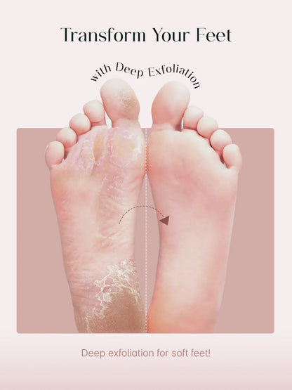 SeoulSkin Glycolic Acid Foot Peeling Mask ( 4,509 Reviews ) MRP : Regular price₹ 649.00 Sale price₹ 499.00 Save ₹ 150.00